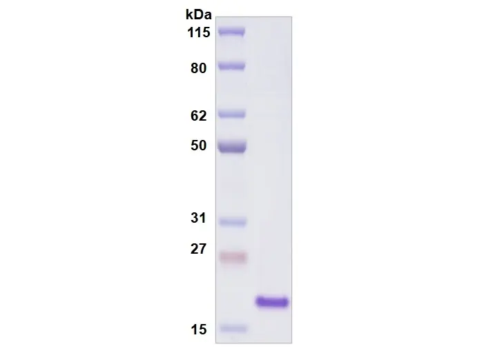 [MC12-100] Recombinant Human Siglec-9, His Tag -100 ug